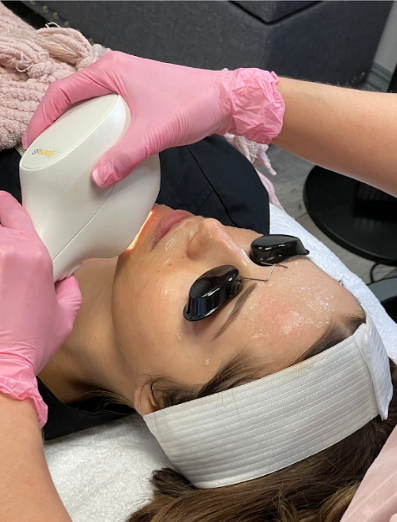 Woman Getting IPL Photo Facial Treatment in Las Vegas, NV | White Coat Aesthetics