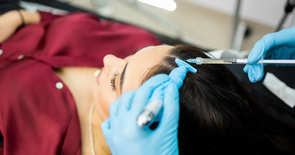 Medical professional performing a PRP injection into the scalp for hair loss treatment and follicle stimulation.