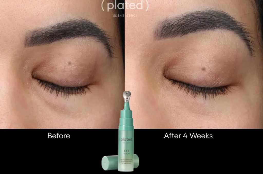 Before and After results of eye serum at White Coat Aesthetics in Las Vegas, NV
