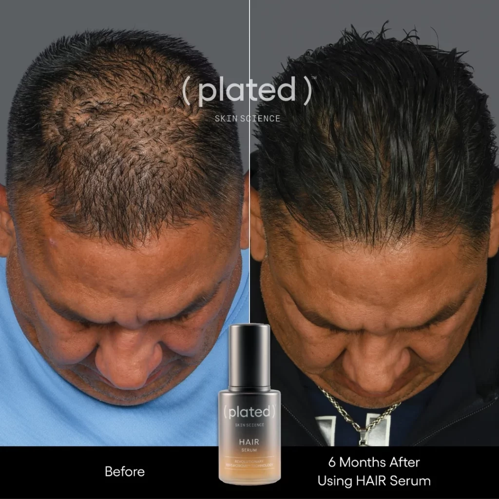 Before and After results of using hair serum at White Coat Aesthetics in Las Vegas, NV