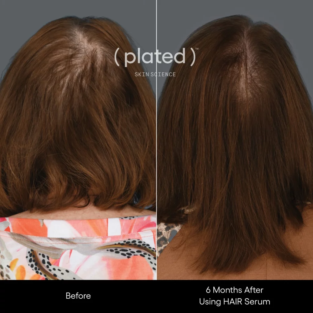 Before and After results of using hair serum at White Coat Aesthetics in Las Vegas, NV