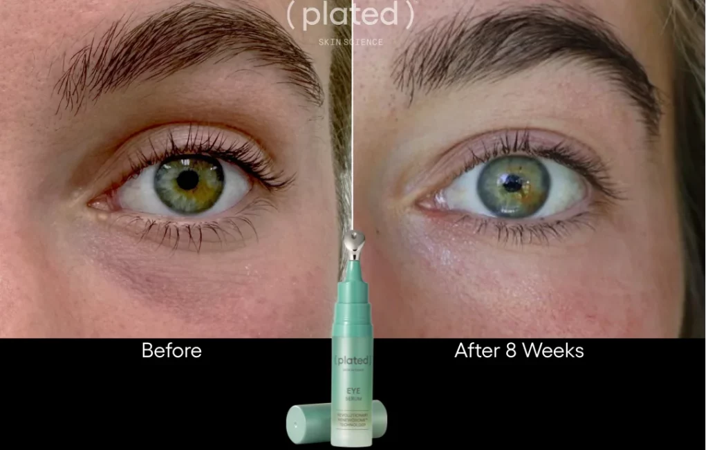 Before and After results of eye serum at White Coat Aesthetics in Las Vegas, NV