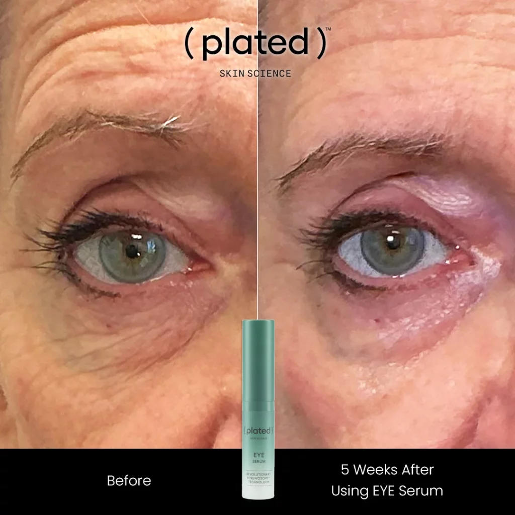 Before and After results of using eye serum at White Coat Aesthetics in Las Vegas, NV