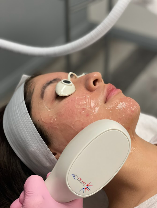 Beautiful Woman Getting Acne Duel-Light Treatment | White Coat Aesthetics in Las Vegas, NV