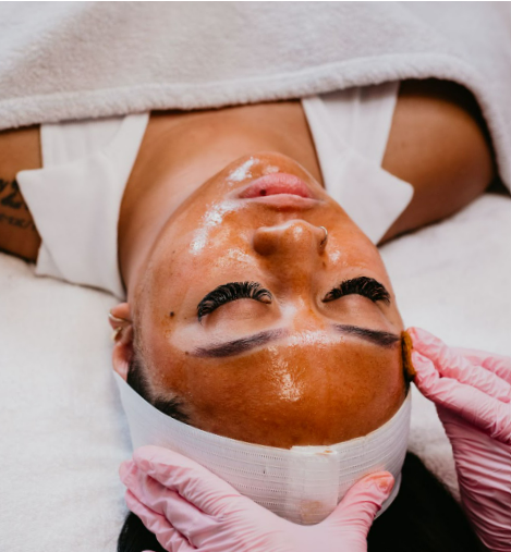 Girl Receiving Chemical Peels Treatment | White Coat Aesthetics in Las Vegas, NV