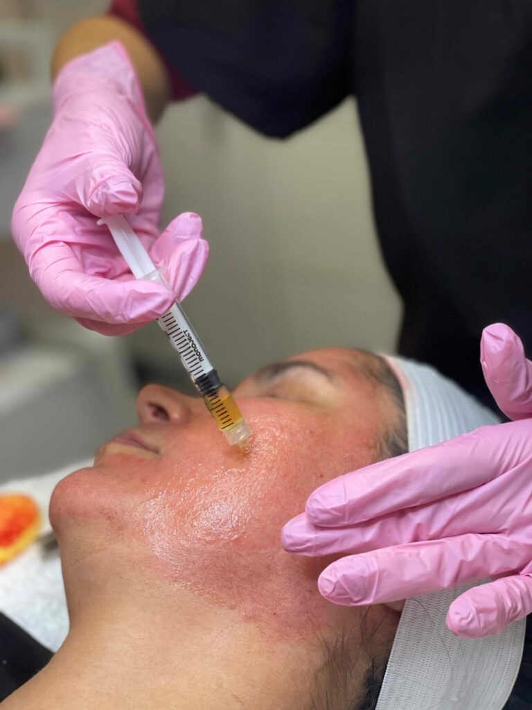 Microneedling | White Coat Aesthetics in Las Vegas, NV