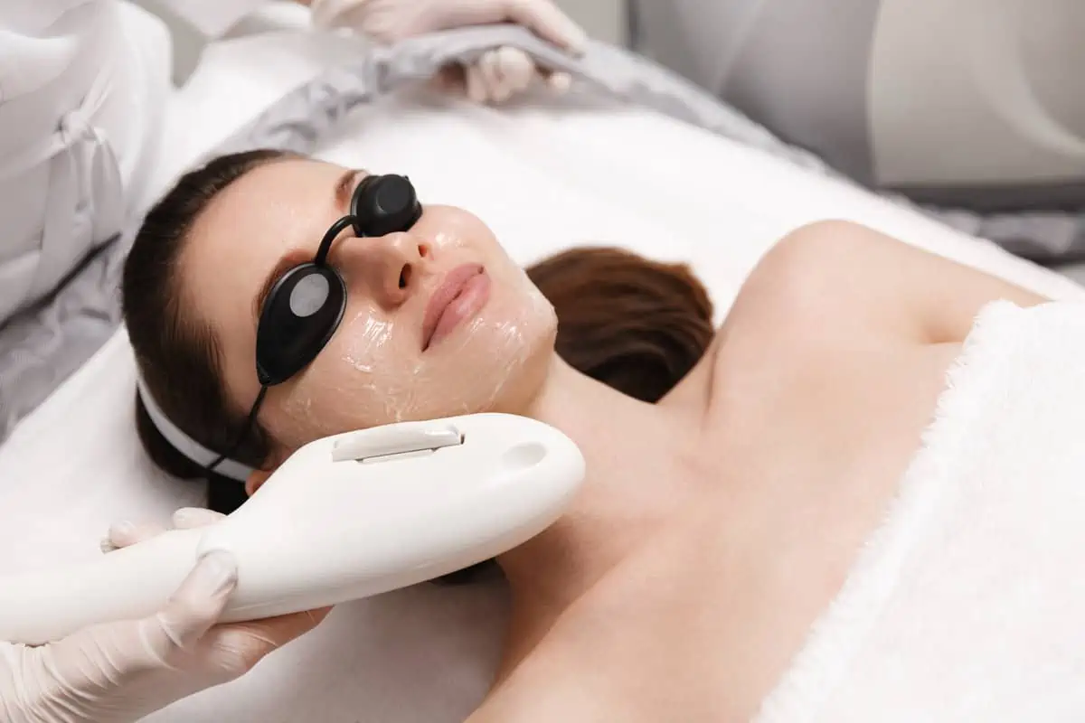 IPL PhotoFacial by White Coat Aesthetics in Las Vegas NV