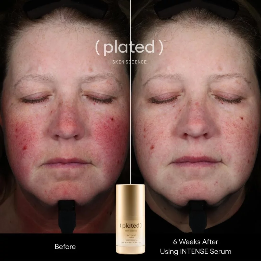 whitecoataesthetics_before_after_10