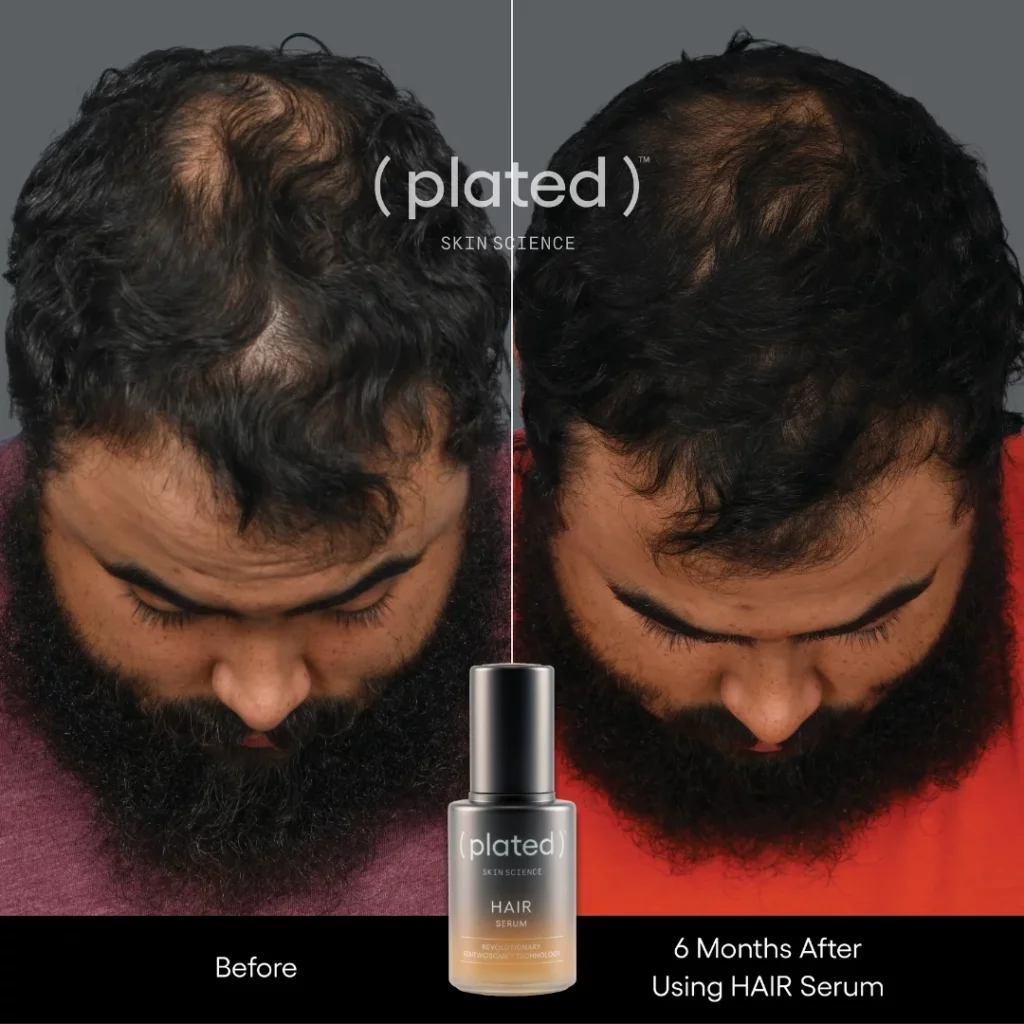 whitecoataesthetics_before_after_13