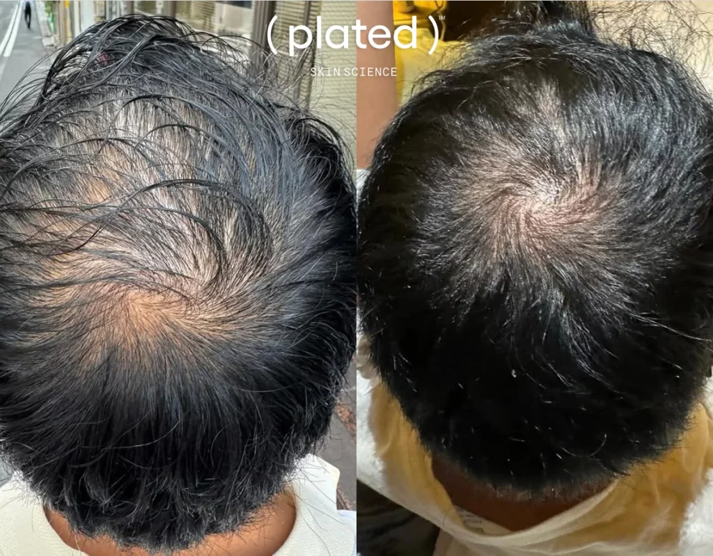 whitecoataesthetics_before_after_16