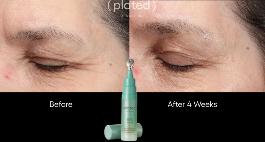 whitecoataesthetics_before_after_2
