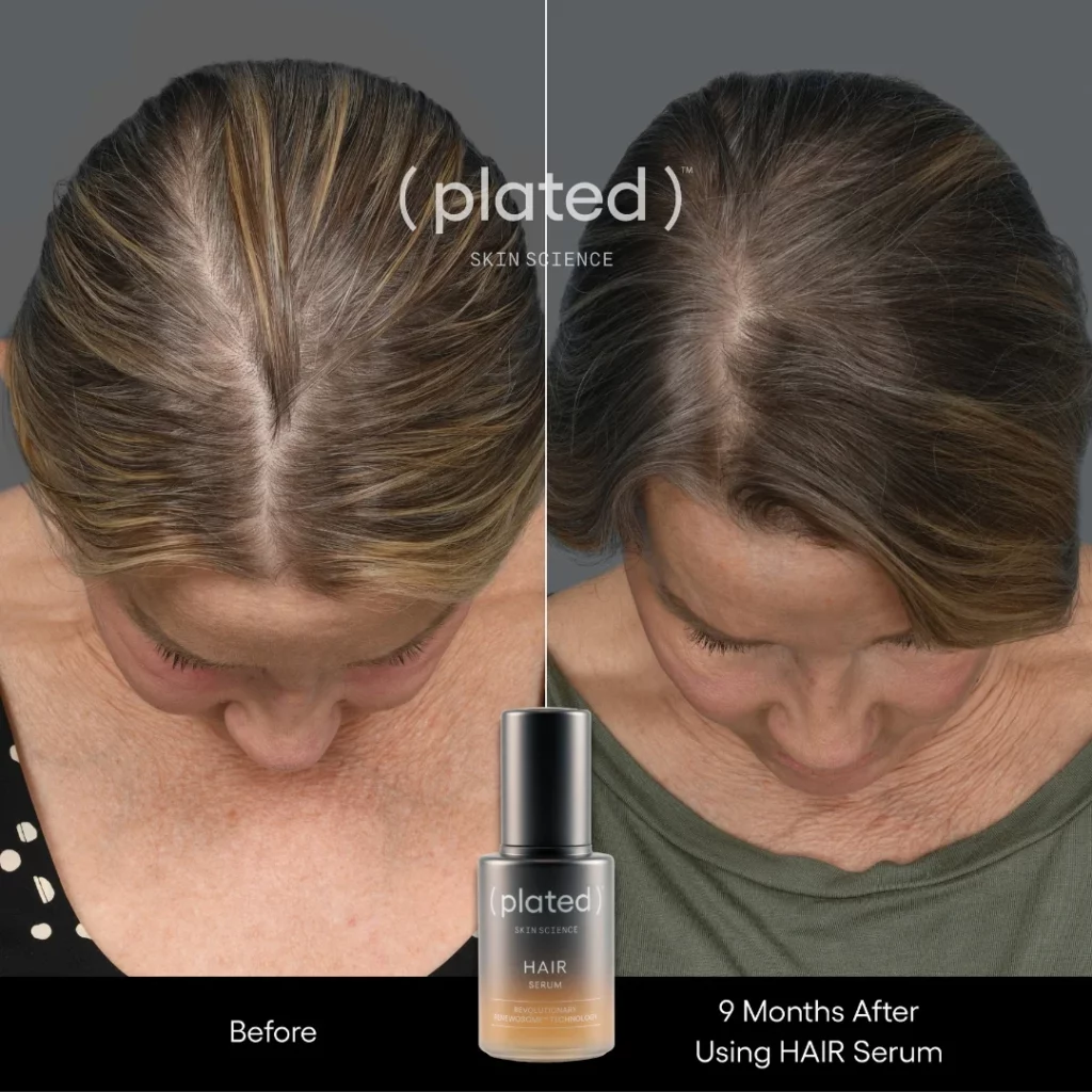 whitecoataesthetics_before_after_9